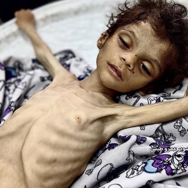 In Loving Memory of Roa Mashi: A Life Cut Short by the Crisis in Gaza